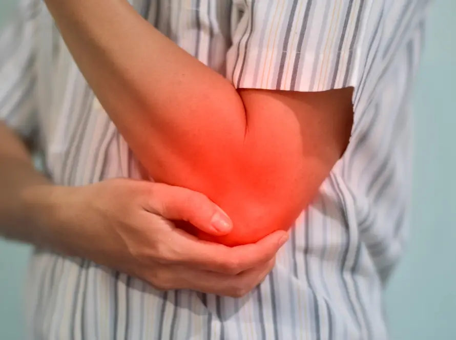 Cubital tunnel syndrome