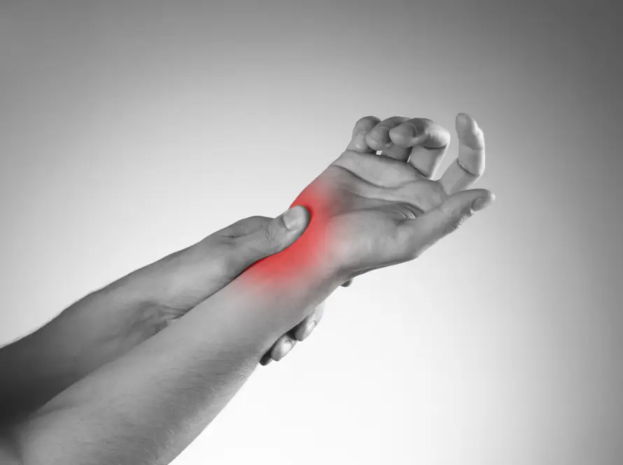 Carpal tunnel syndrome