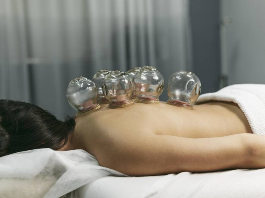 Cupping therapy